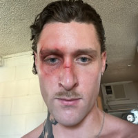 KETTAMA - It Gets Better (Edit)